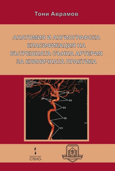 Анатомия и ангиографска класификация на вътрешната сънна артерия за клиничната практика