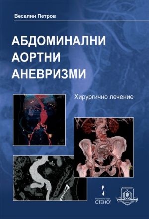 Абдоминални аортни аневризми - хирургично лечение