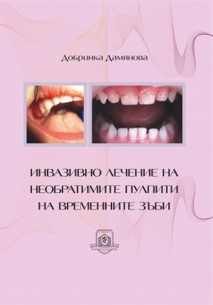 Инвазивно лечение на необратимите пулпити на временните зъби